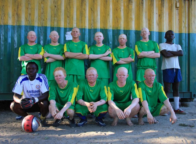 albino united fc